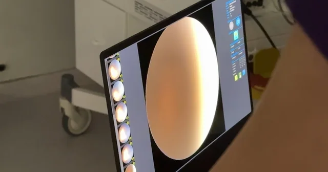 Rize de prematüre retinopatisi tanı ve tedavisi yapılabilecek Rize Haberleri