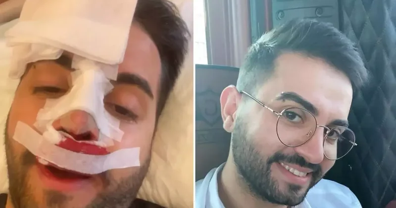 Kadir Ezildi burnu sargılı fotoğrafıyla korkuttu! Gerçek sonradan ortaya çıktı