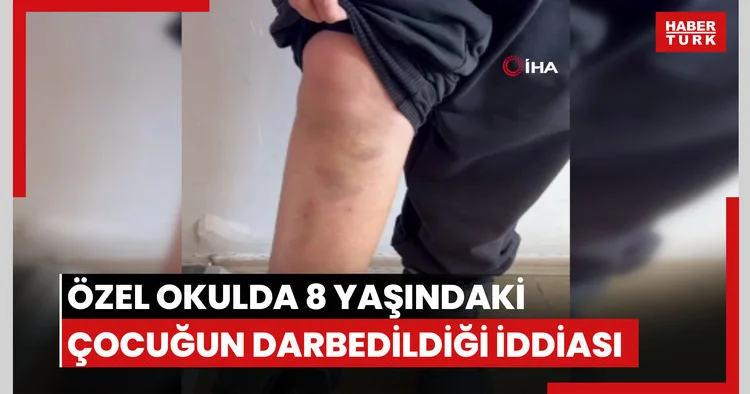 Diyarbakır da özel okulda 8 yaşındaki çocuğun darbedildiği iddiası