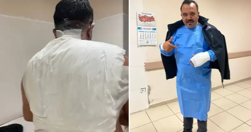 Soğuk hava deneyi facia ile bitti: Sıcak suyla kendini yaktı Gündem Haberleri