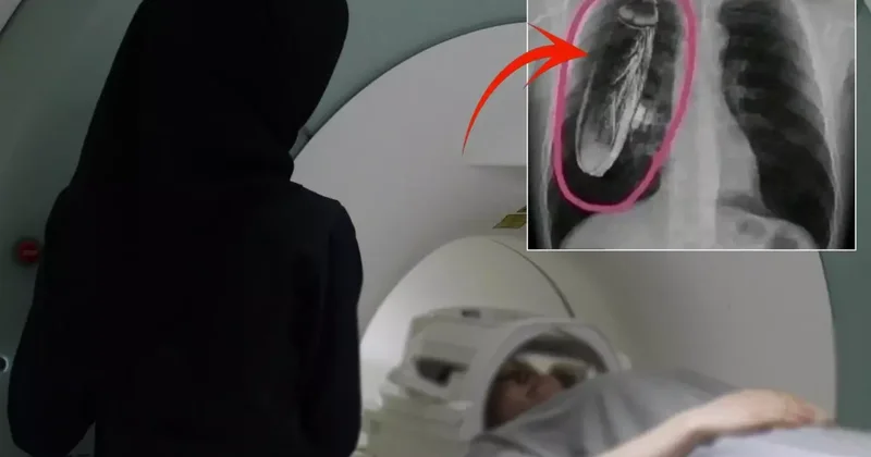 Hastaya Göğsünde canlı böcek var dendi, gerçek çok başka çıktı
