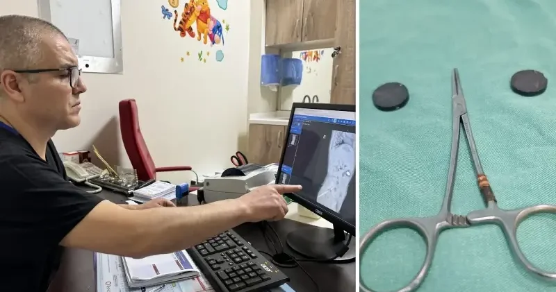 Karaman da tuvaletini yapamayan çocuğun bağırsağından iki mıknatıs çıkarıldı Sağlık Haberleri