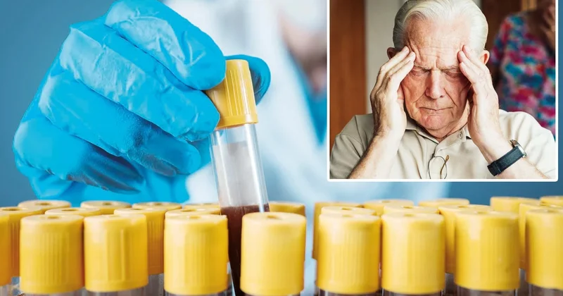 Kan testiyle Alzheimer’a erken teşhis