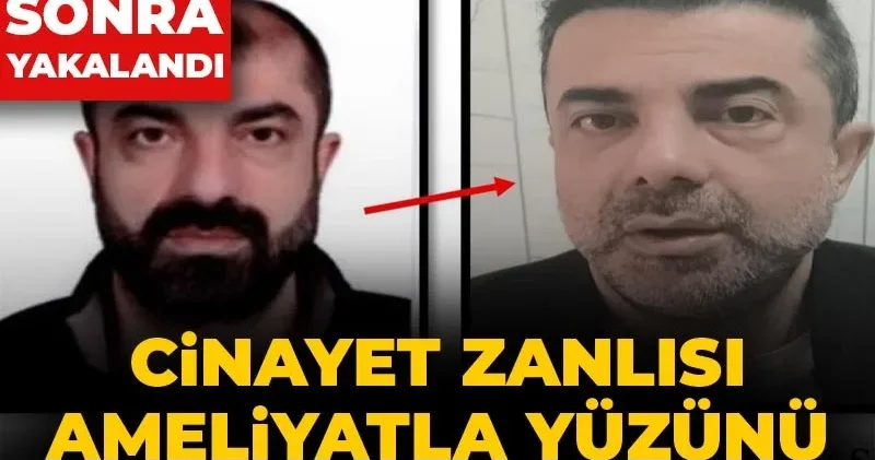 Cinayet zanlısı ameliyatla yüzünü değiştirip saklandı: 7 yıl sonra yakalandı