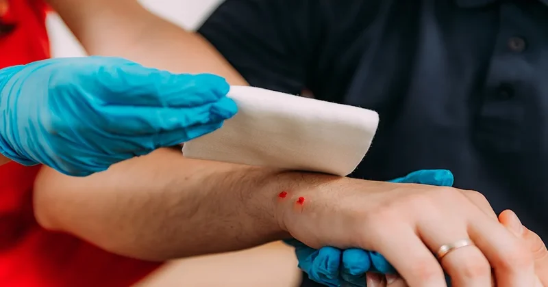 Yılan ısırmasında ilk yardım sandığınız şey aslında en büyük yanlışmış Sözcü Gazetesi