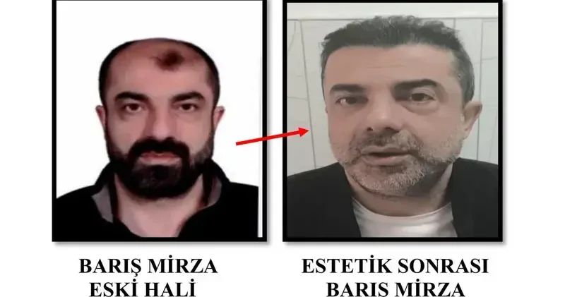 Cinayette azmettirmekten aranan şüpheli, ameliyatla yüzünü değiştirmiş