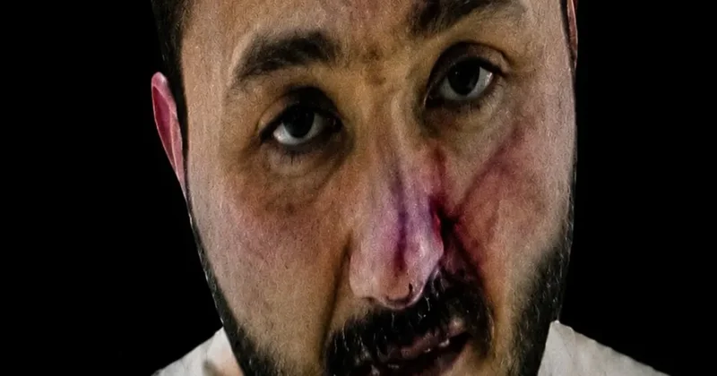 Polislerimizi şehit eden saldırganla ilgili şok detay... Şizofreni hastası
