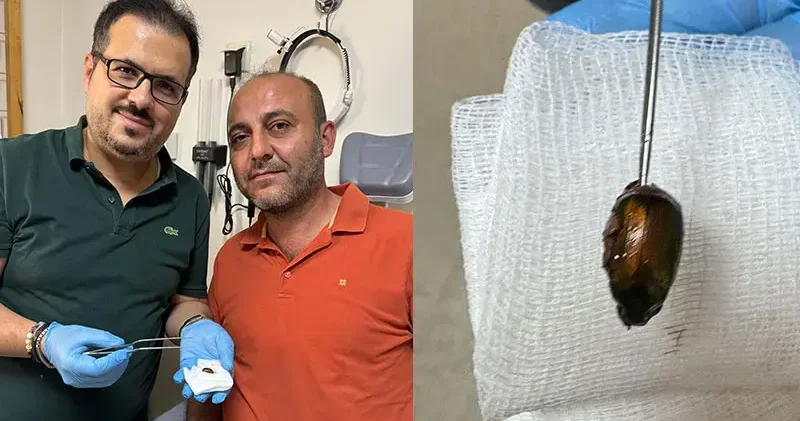 Ağrı ve işitme kaybı nedeniyle gittiği hastanede, kulağından böcek çıktı