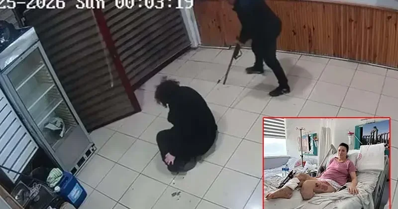 Boşanma aşamasındaki eşini bacaklarından vuran sanık: İçeride ne oldu, hatırlamıyorum