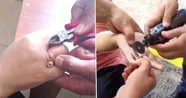 Parmaklarına sıkışan yüzükleri itfaiye çıkardı