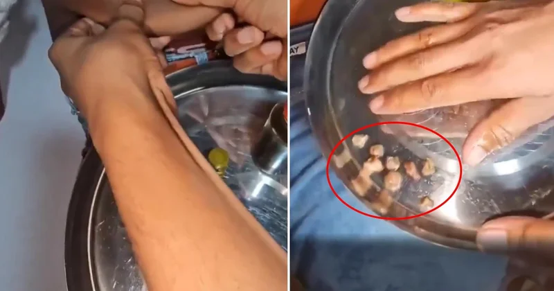 “Böbrek taşı döküyor” dendi! Yaptığı numara kısa sürede anlaşıldı