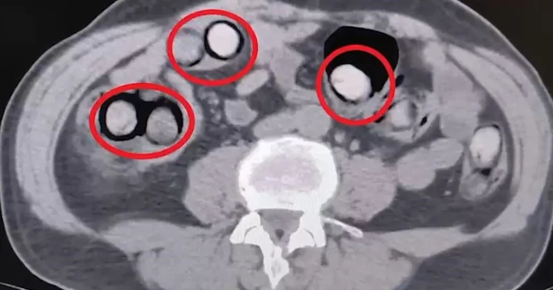 Tatvan da durdurulan otobüste 758 gram metamfetamin taşıyan yolcu tutuklandı