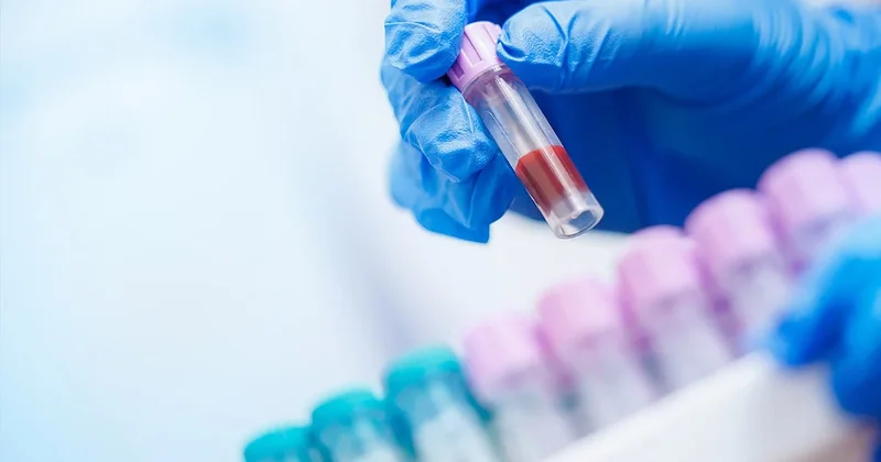 Yasaklı madde testlerinde bilinen yanlışlar neler? Saç boyatmak, su içmek, tırnak kesmek… Sözcü Gazetesi