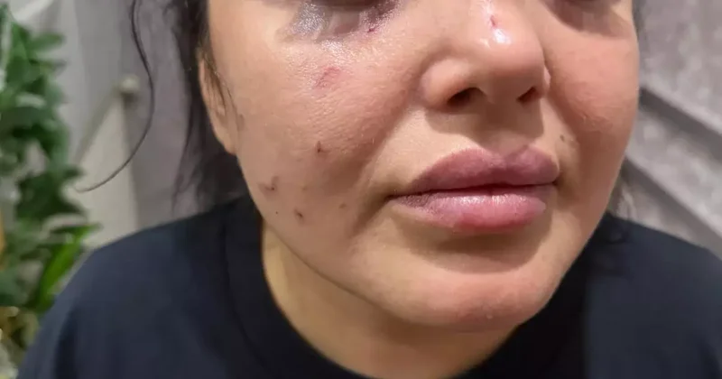 Beykoz da dehşet anları! Ofisi basan grup eski patronlarını sokak ortasında darp etti