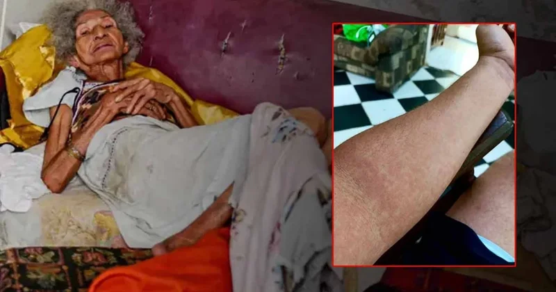 Birdenbire yaşlanıyorlar, virüs ülke halkını zombiye çevirdi! Sokaklar yürüyemeyen insanlarla dolu Sözcü Gazetesi