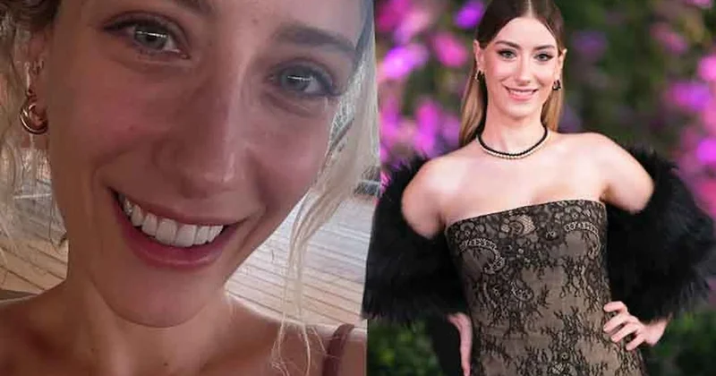 Hazal Kaya dişlerini söktürüp yeniden yaptırdı: Ölüyorum sandım Sözcü Gazetesi