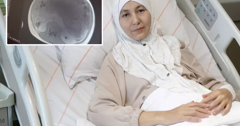 Kazakistanlı kadının karnından yaklaşık 45 santimetrelik tümör çıkarıldı