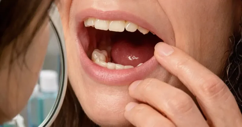 Sabah uyandığında dişleri yoktu! Doktorları bile şaşırtan gerçek hastaneye ortaya çıktı