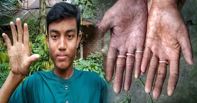 Milyarlarca insanda var, onlarda yok: Modern dünya onları yok sayıyor Sözcü Gazetesi