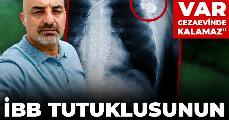 İBB tutuklusunun kalp pili kaydı: Hayati tehlike var cezaevinde kalamaz