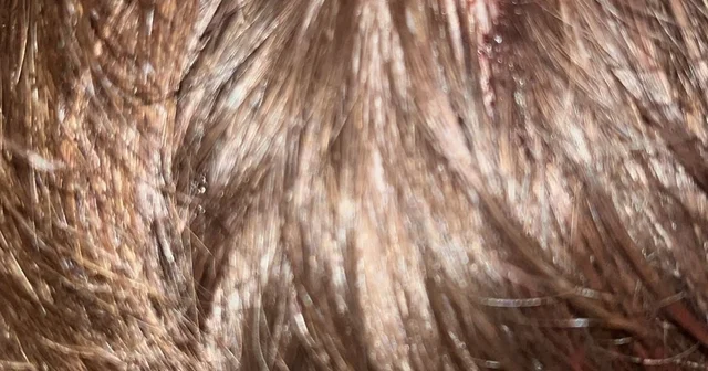 Kucağında bebeği ile darbedilen babanın oğlu, sokakta başına atılan taşla yaralandı Yalova Haberleri