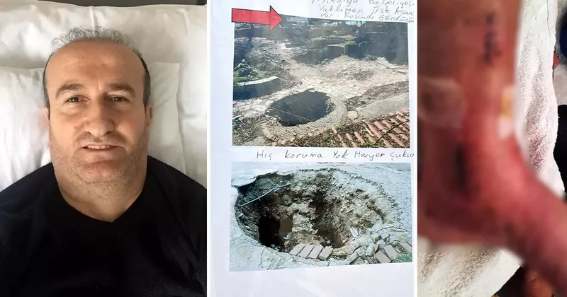 Tatili kabusa döndü! 2 metrelik çukura düştü: Ömrümü yediler, sakat bıraktılar