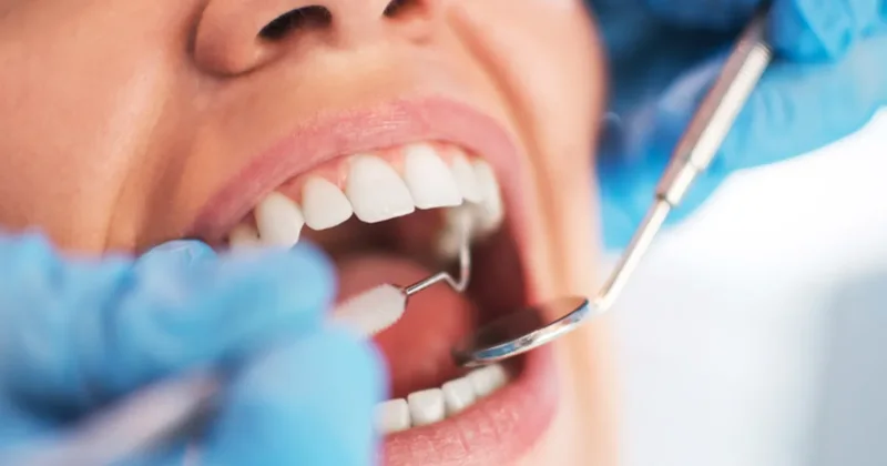 Diş sağlığı vücut sağlığını doğrudan etkiliyor! Kanseri bile tetikleyebilir