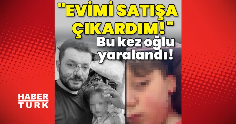Bu kez oğlu yaralanan baba: Evimi satışa çıkardım! Son dakika haberleri