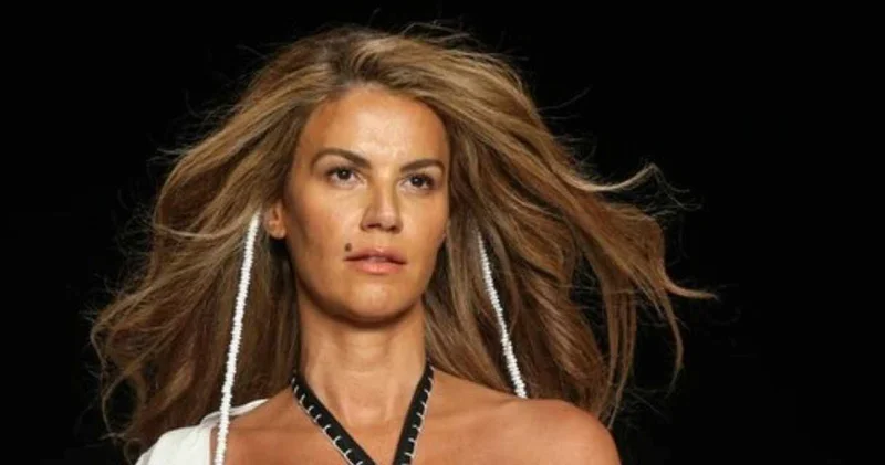 Ünlü model Tülin Şahin den kötü haber: Ameliyat masasına yatıyor!