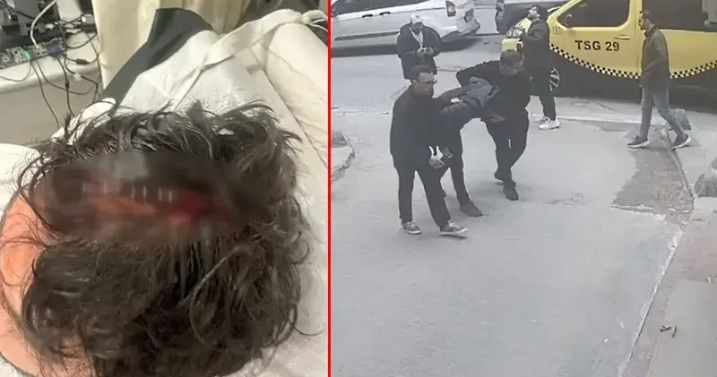 Beyoğlu’nda kaldırımda yürürken başına cam düştü; 7 dikiş atıldı