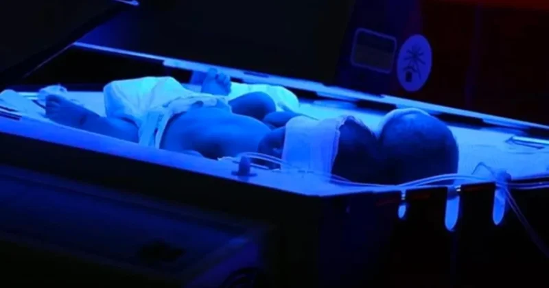 İstanbul da kuvözde unutulan 17 günlük bebek yandı Sözcü Gazetesi