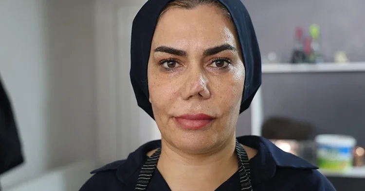 Kırılan burnunu düzeltmek istedi, hayatı kabusa döndü: Doktoruna dava açtı