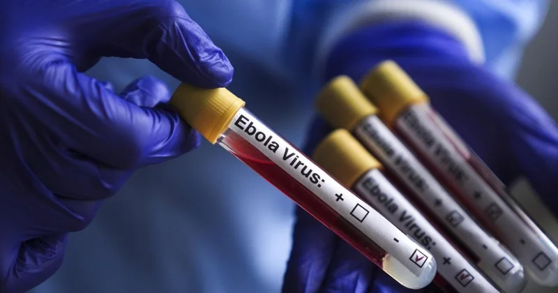 DSÖ: KDC de Ebola salgını, uluslararası öneme sahip halk sağlığı acil durumu olmaya devam ediyor