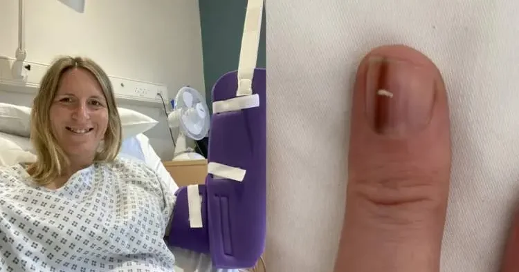 Tırnağındaki çizgi hastalığının habercisi oldu! Uzmanlar bu belirtiye dikkat çekiyor