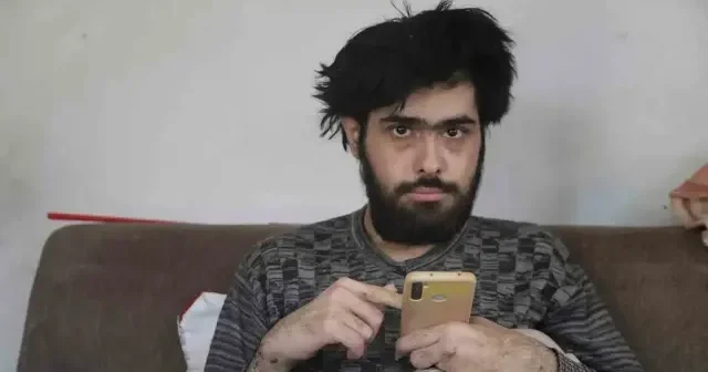 Üç yıldır evden çıkmıyordu: Depremzede Barış hayata dönüş yolunda ilk adımı attı Hatay Haberleri