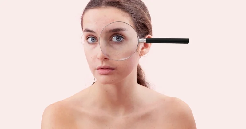 Göz altı halkaları yüzümüzün CV’si: