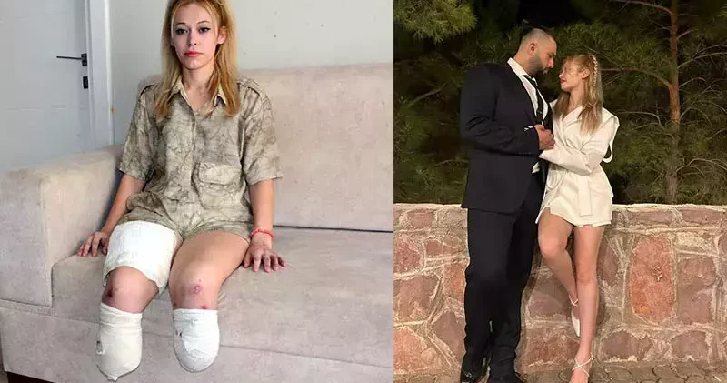 İrem’in bacaklarını kaybettiği kazada TIR şoförü: Arızaya bakmak için indiğimde araç hareket etti