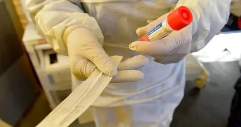 Adlî Tıp Kurumu Başkanı Aslıyüksek ten uyuşturucu testi açıklaması: Kan, idrar ve saç testlerinin sonuçları ne kadar sürede çıkıyor?