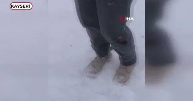 Kayseri’de başıboş köpeğinin saldırısına uğrayan çocuk yaralandı