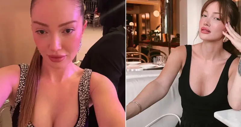 Danla Bilic altıncı kez ameliyat masasına yatacak: Yanlış dolgu operasyonunun sonuçları