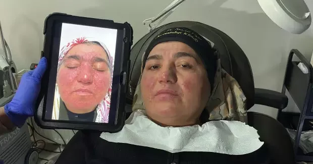 Sivas haberleri Hastalığı nedeniyle yıllarca evden çıkamayan kadın: Oğlumun düğününe gidemedim 20 Şubat 2026