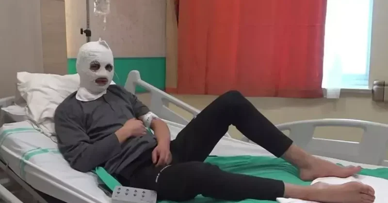 Çakmak gazı faciası! Bomba gibi patladı: Ben yandım, başkası yanmasın