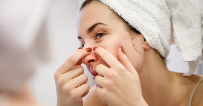 Güzel görünmek için sivilceyi patlatıyor musunuz? İşte bilmeniz gerekenler