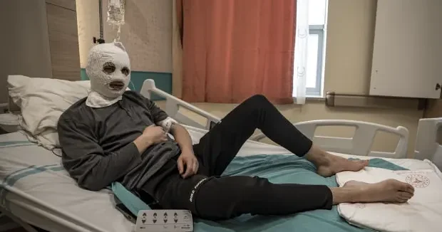 Erzurum haberleri Çakmak gazı faciası! Vücudu yandı 20 Şubat 2026