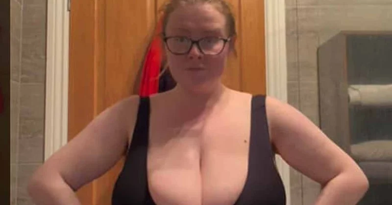 Zayıflarken göğüsleri büyüdü: Dünyada 300 kişide var Sözcü Gazetesi