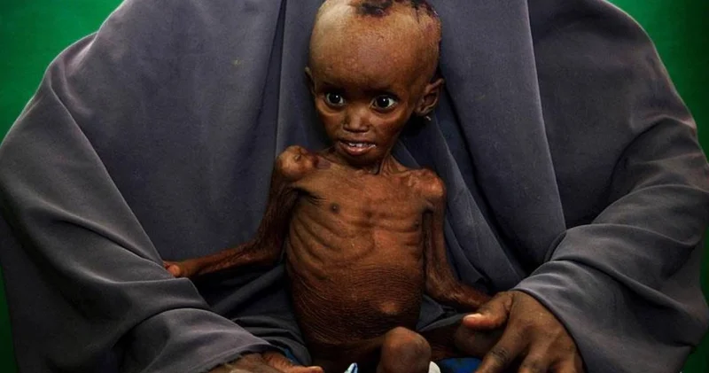 Somali alarm veriyor: 4,4 Milyon kişi açlıkla karşı karşıya
