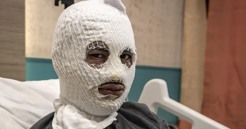 Çakmağına doldurduğu gaz az kalsın öldürüyordu: Ben yandım, başkaları yanmasın