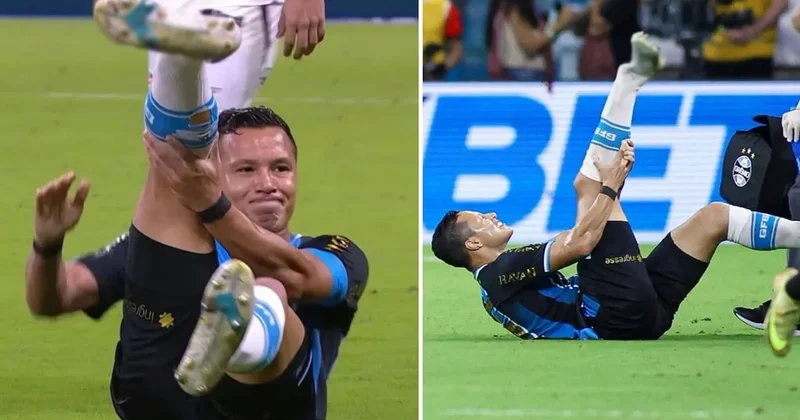 Süper Lig in eski yıldızının talihsiz anı: Ayağı kötü şekilde kırıldı Sözcü Gazetesi