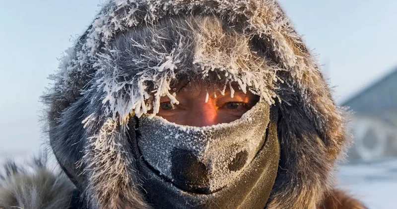 Donarak ölen adam tekrar canlandı, 5 gün sonra yürüyerek taburcu oldu