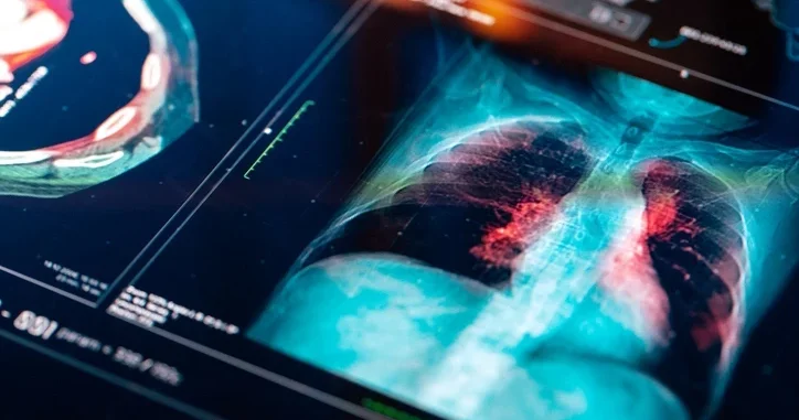 Akciğerde çığır açan keşif: Hücrelerin ‘onarım düğmesi’ bulundu! ‘Süreci tersine çevirebilme potansiyeli taşıyor